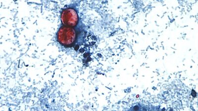 cyclosporasis.jpg