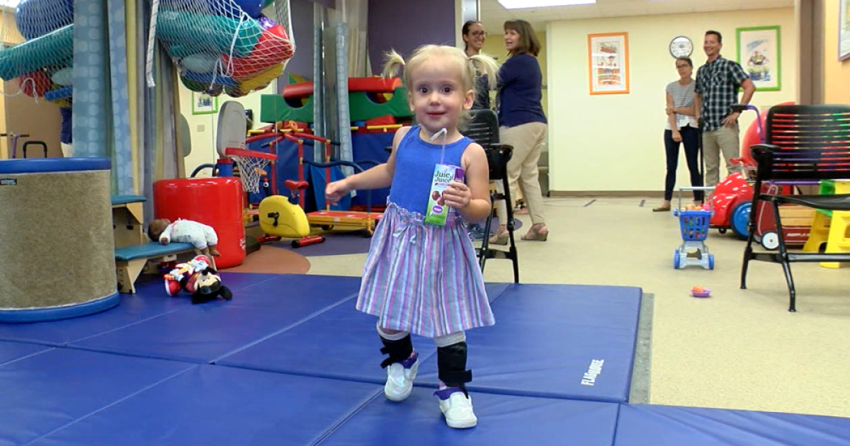 Baby Shark Helps Toddler With Spina Bifida Learn To Walk