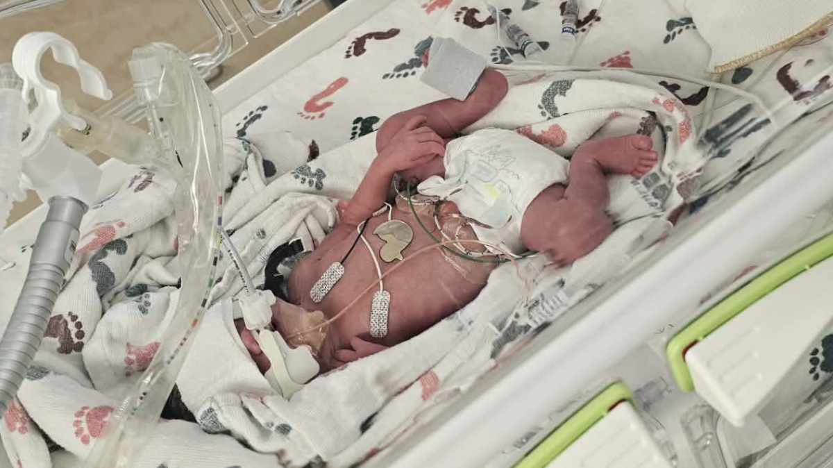 Baby Ophelia in the NICU