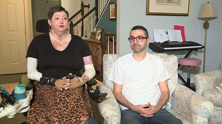 Liz Burn Recovery 04.png