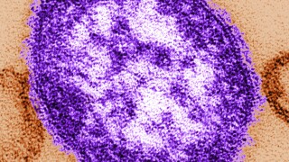 Measles-Explainer