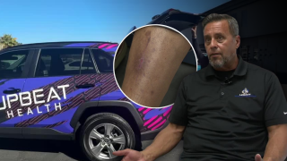 Man's skin cancer diagnosis highlights Southern Nevada's primary care shortage