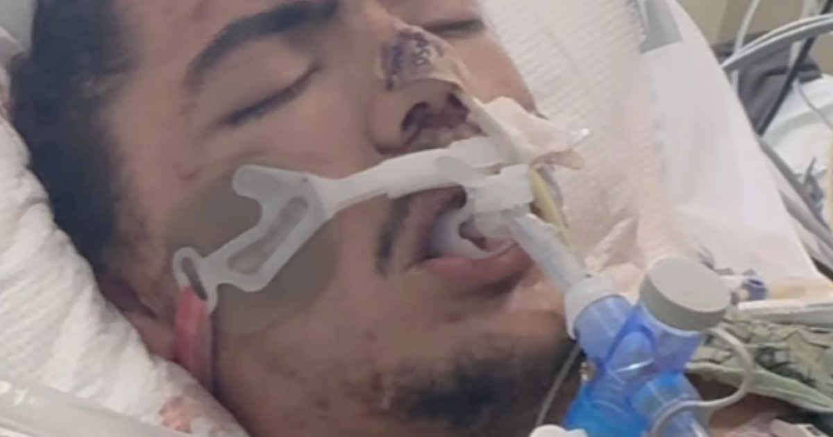 Lakeside man defies medical odds, walks again after severe motorcycle crash and brain bleed