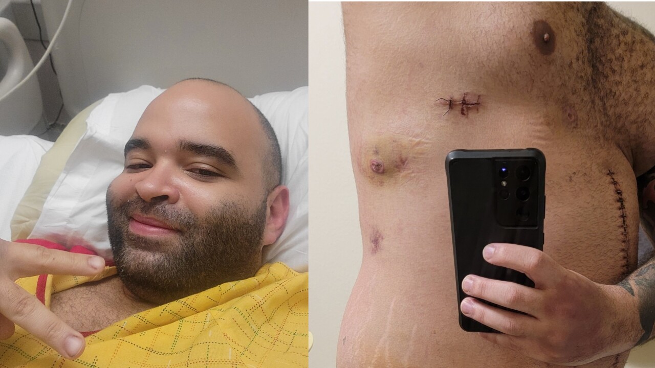 Thomas James hospital selfie and healing wounds