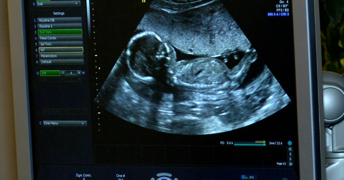 Boy Or Girl The Earliest Gender Reveal Available In Western New York