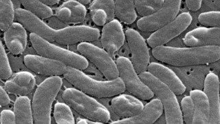 Be Well-Vibrio Illnesses