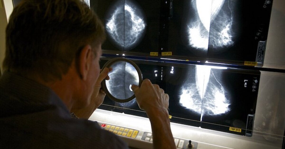 New drug for advanced breast cancer guided by blood test approved by FDA
