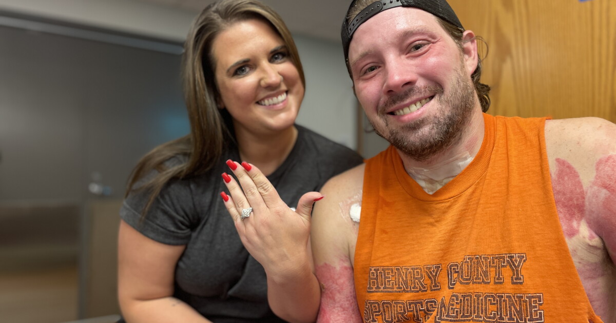 Burn survivor proposes to girlfriend at Indianapolis Hospital - Vimarsana News