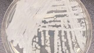 A petri dish with Candida auris cultured in it.