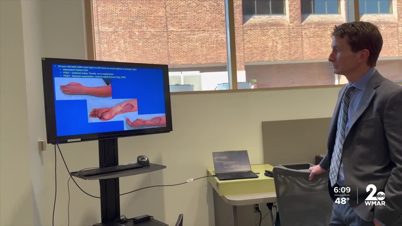 Reconstructive surgery on hand.jpg