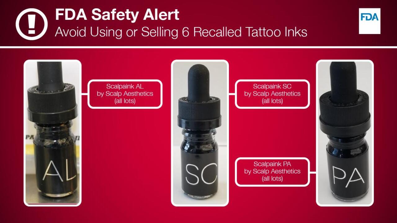 Popular Tattoo Ink Recalled By Fda Due To Bacterial Contamination
