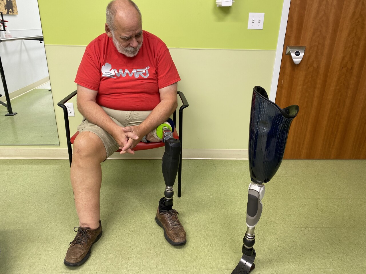 Mike's new leg pic 2.jpg