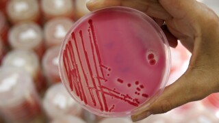 salmonella culture_generic.jpg