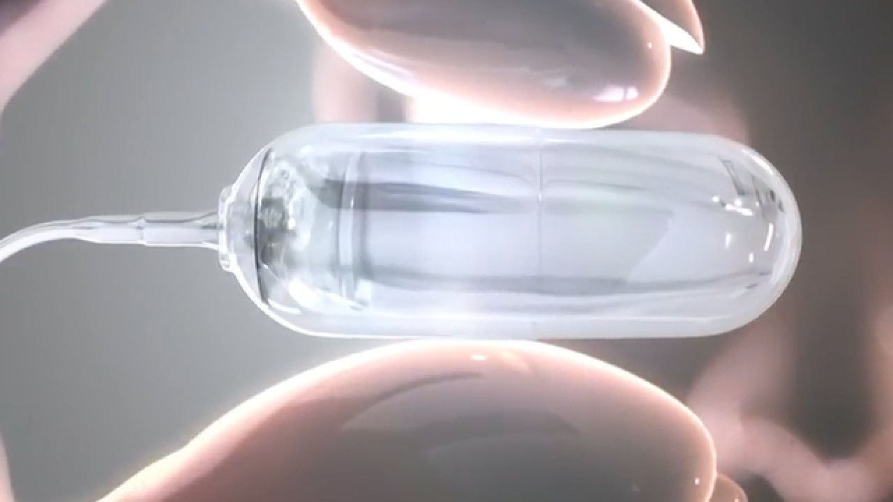 Weight Loss Balloon Pill >> University Of Colorado Hospital To Offer New Balloon Capsule To Weight Loss Balloon Pill >> University Of Colorado Hospital To Offer New Balloon Capsule To