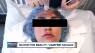 The 'blood facial' that has women flocking into spas, doctors offices across metro Detroit