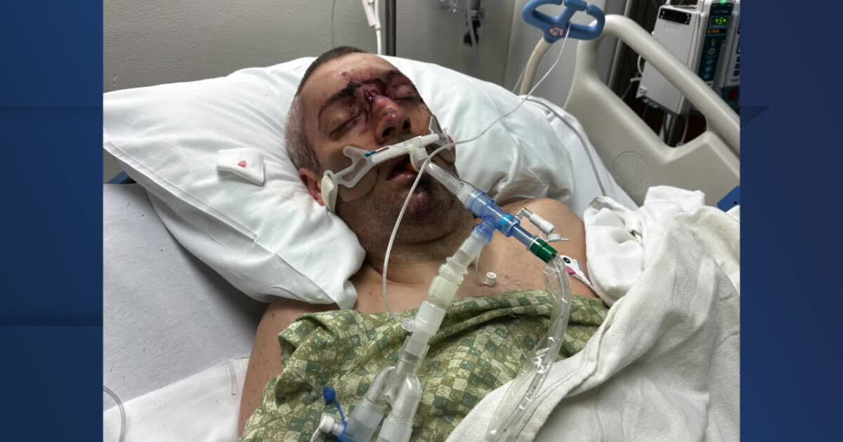 Local man who almost died in motorcycle crash reminds drivers to look twice - Vimarsana News