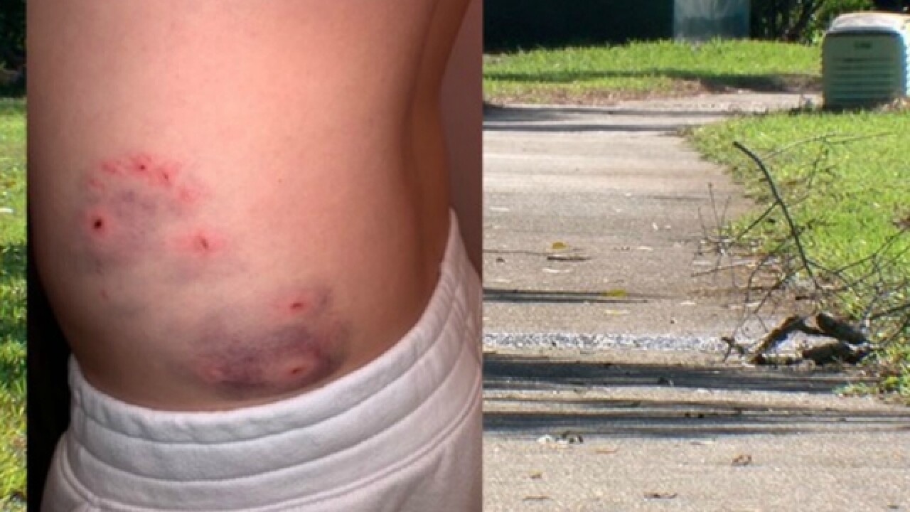 Teen Hospitalized After Dog Reportedly Bites Him On Walk In Palm Harbor Neighborhood