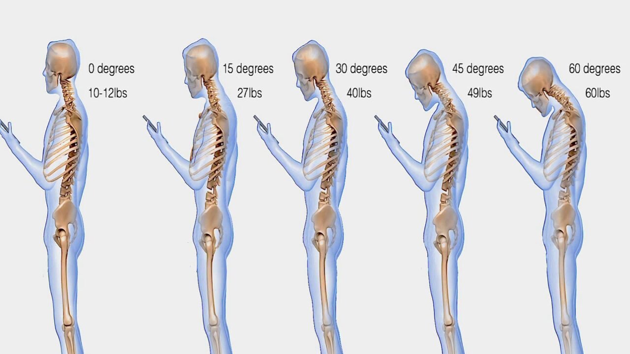 Here S Exactly Why The Weight Of Your Head Is Causing Problems