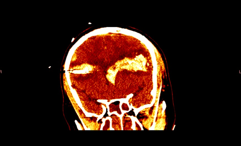 Screenshot 2024-09-01 215717.png