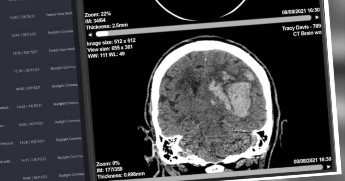 A.I. Week: How artificial intelligence is revolutionizing the medical world