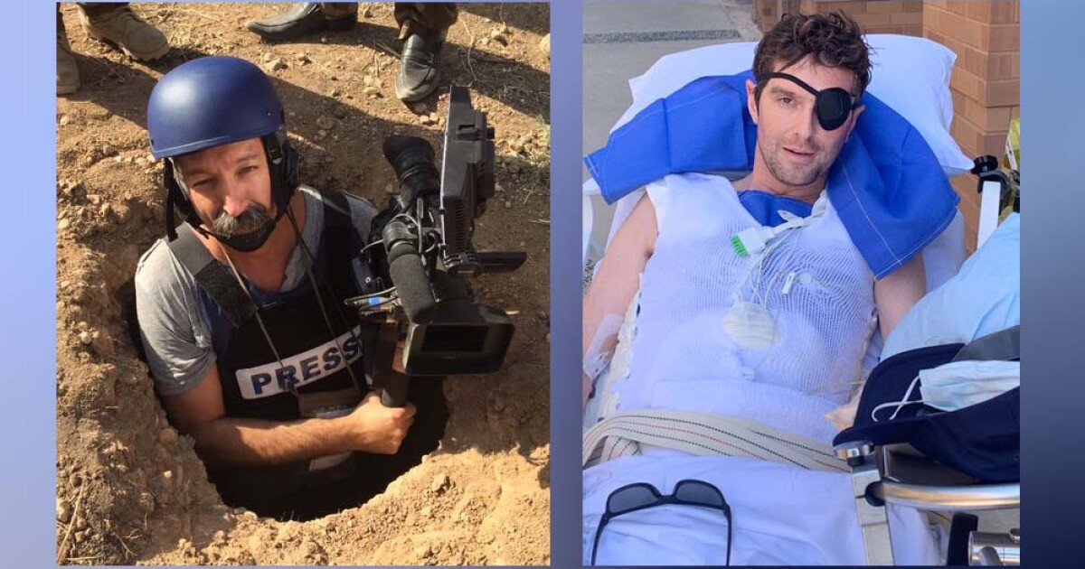 'Lucky to be here': Fox News correspondent Benjamin Hall recovers after Ukraine attack