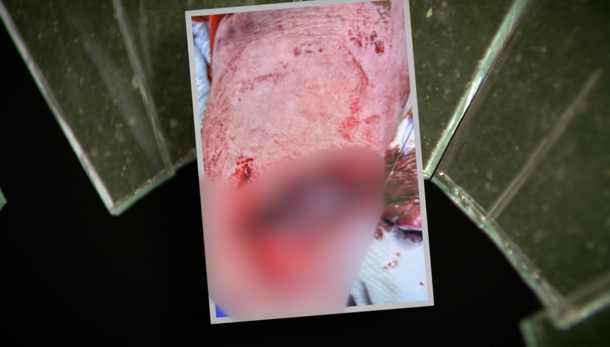 OXFORD MOM'S FREAK ACCIDENT