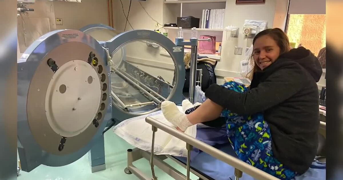 Hyperbaric pressure key to Sarah's chance to Summit 14'er after 500 foot fall - Vimarsana News