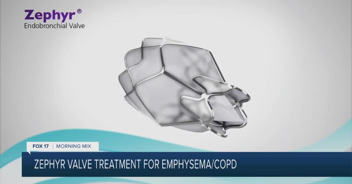 Zephyr Pacemaker Spectrum Health offers Zephyr® Valve Treatment for Emphysema/COPD
