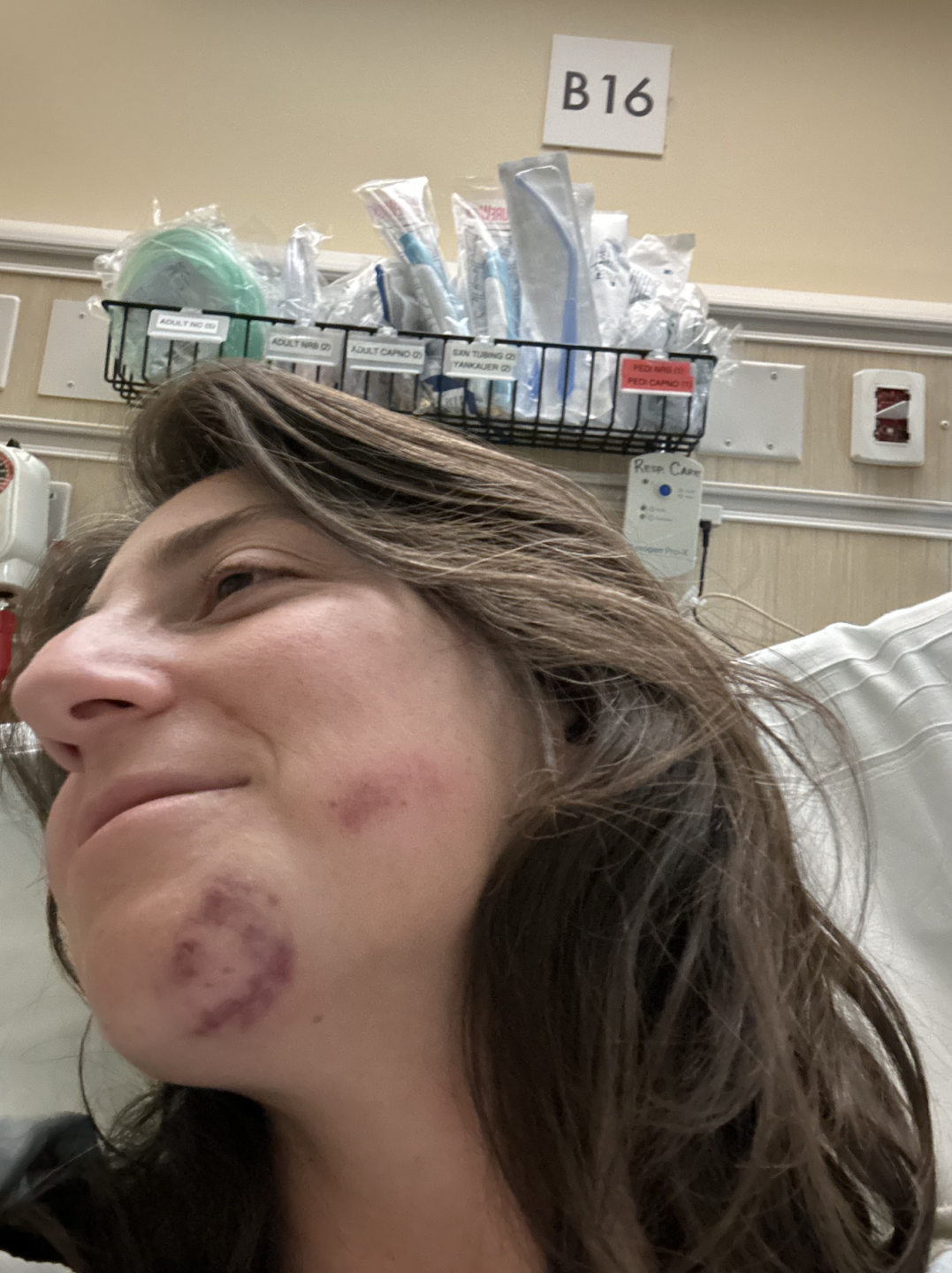 Jana in the hospital for her concussion