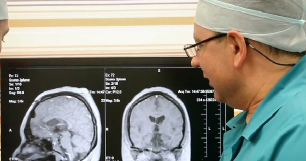 Alzheimer's prevention study