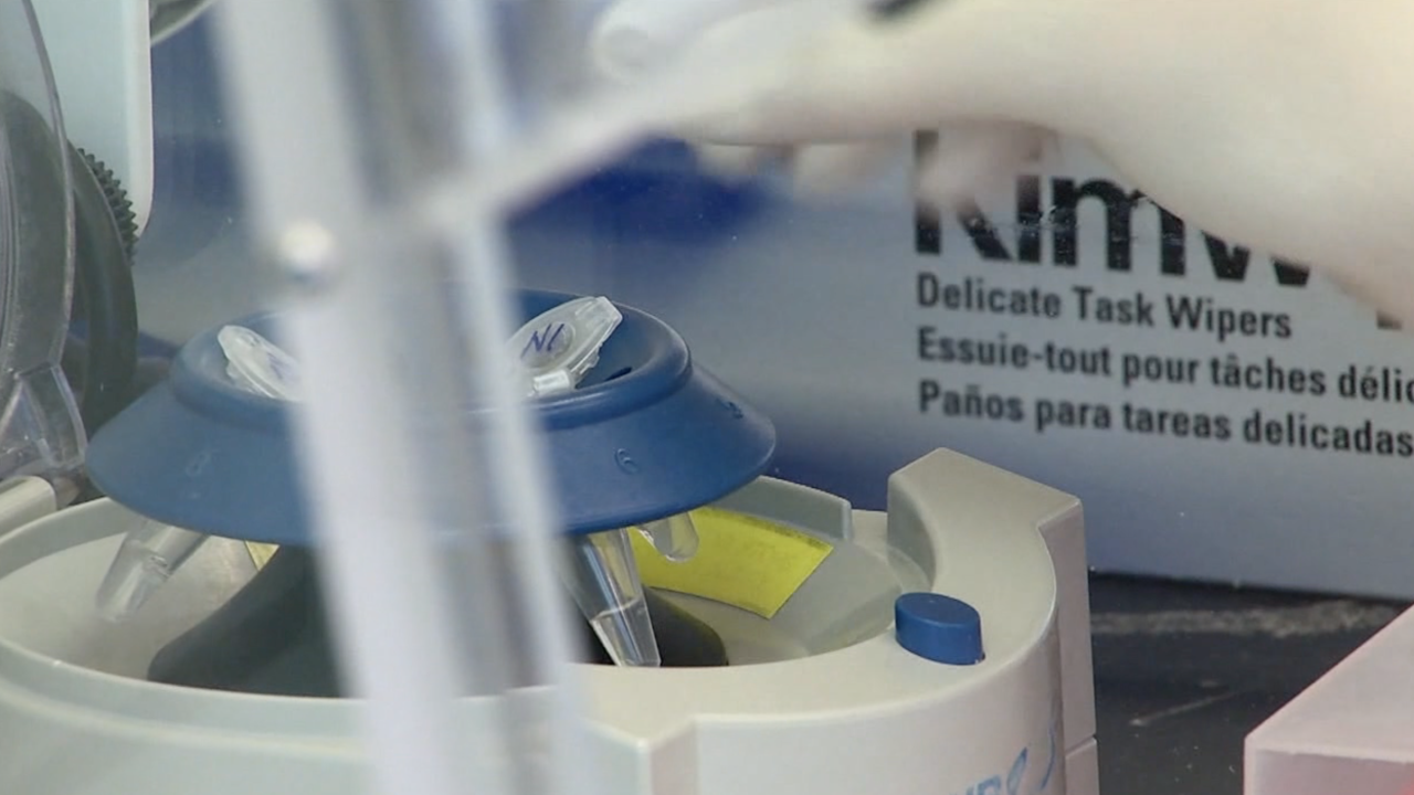 University Of Arizona To Provide Covid 19 Antibody Tests To Health Care Workers And First Responders