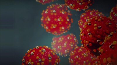 Measles is making a big comeback