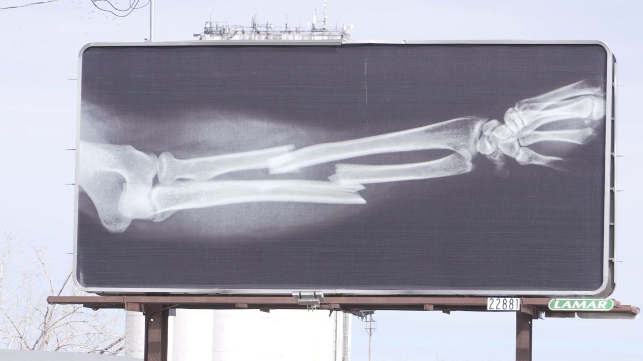 Great Falls Clinic OrthoNOW