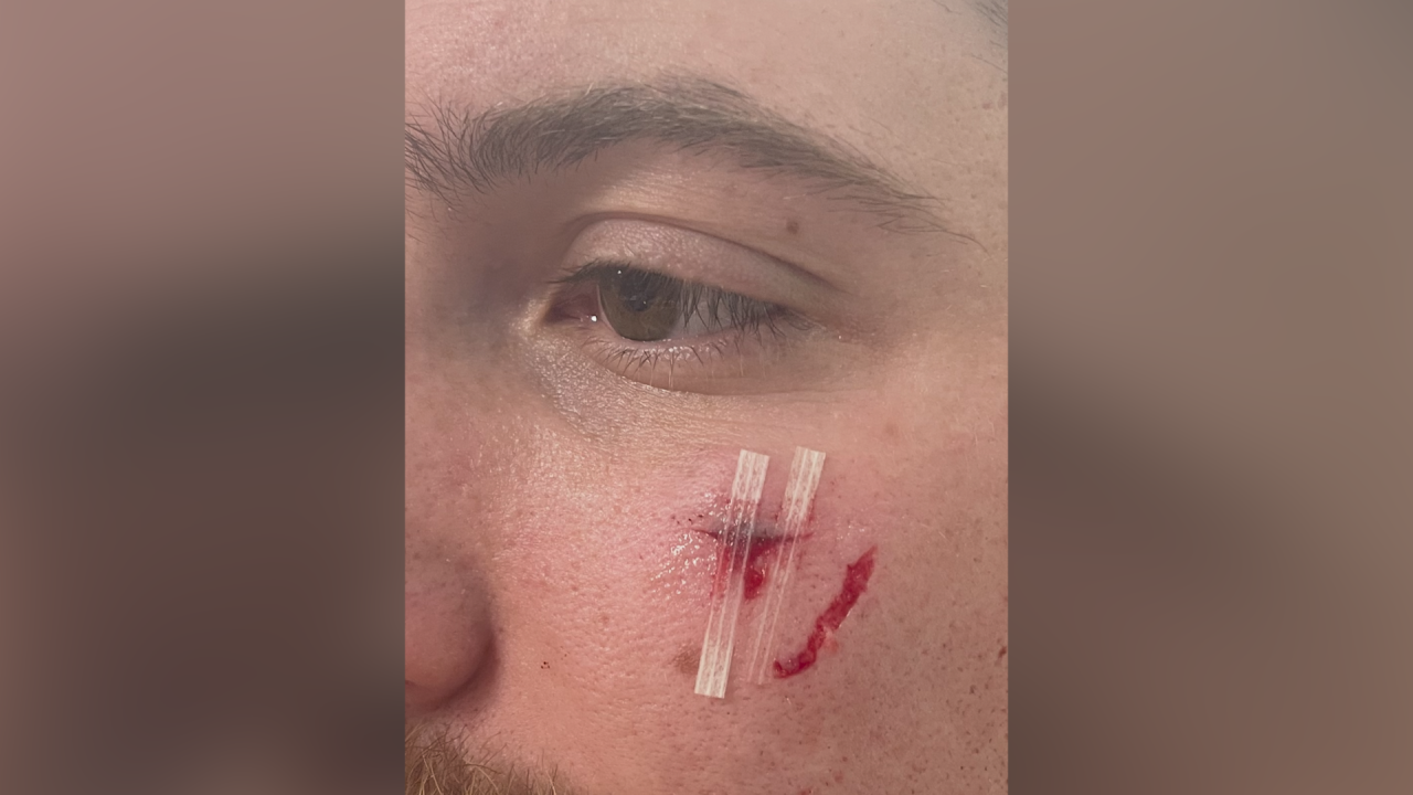 Detention officer injured at Lewis and Clark County Jail