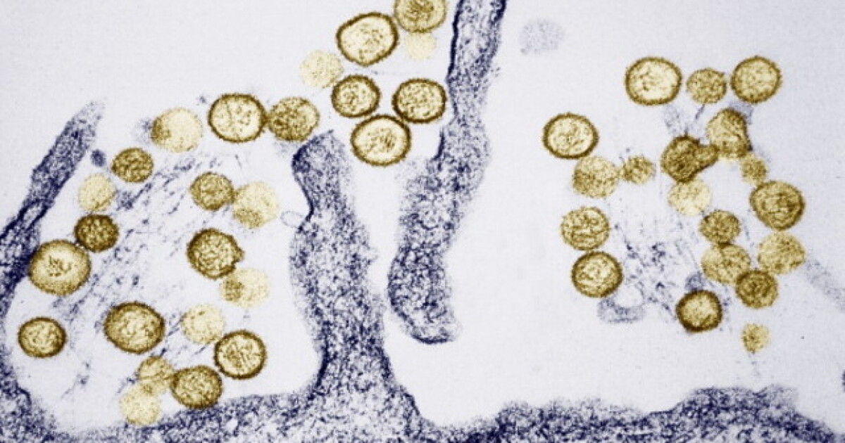 Deadly hantavirus found in deer mouse near Mount Laguna - Vimarsana News