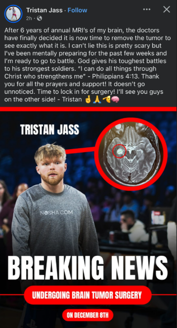 Tristan Jass announces on Facebook his decision to get brain surgery