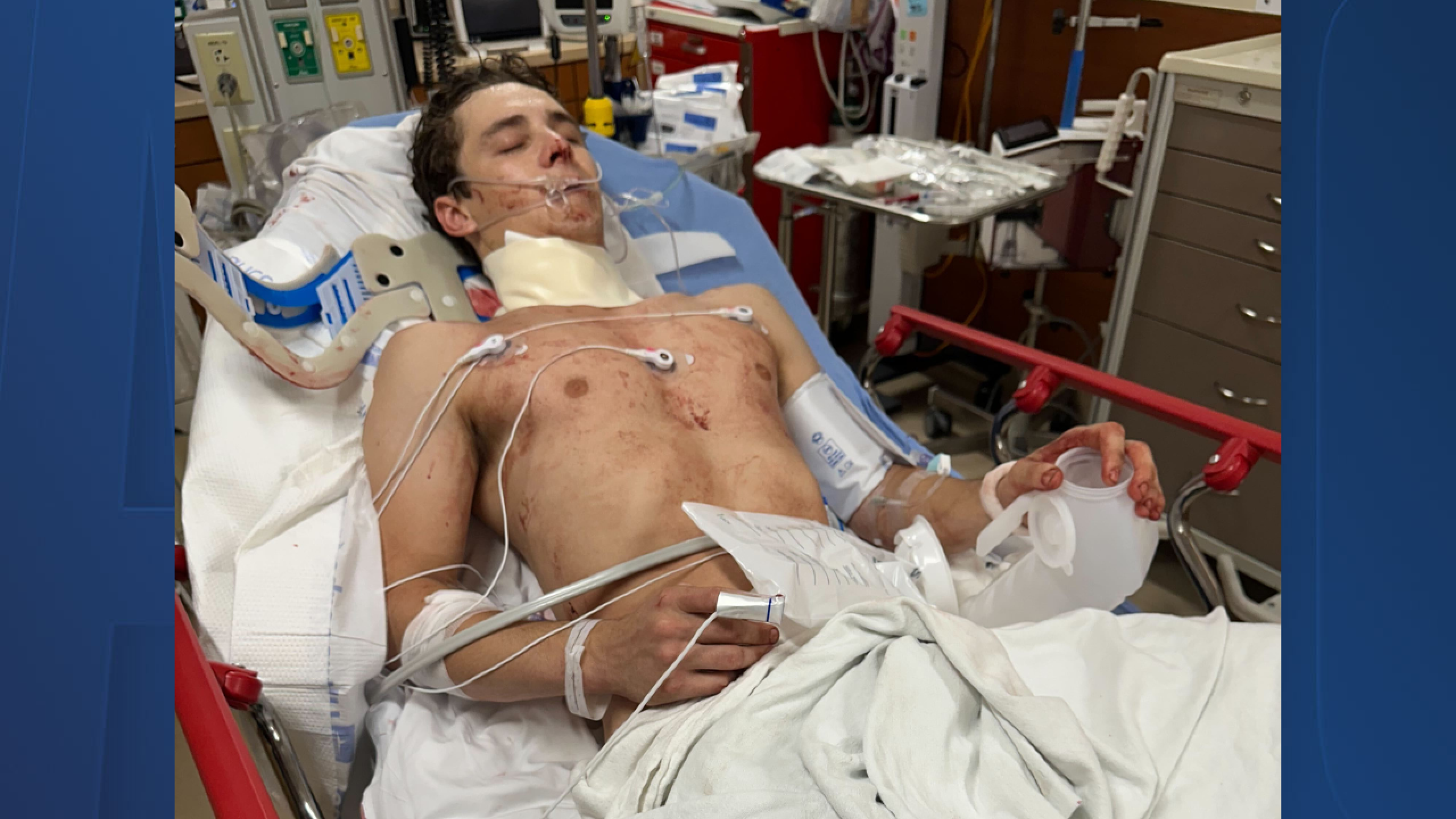 Bull rider survives a near-fatal accident during a Florida competition