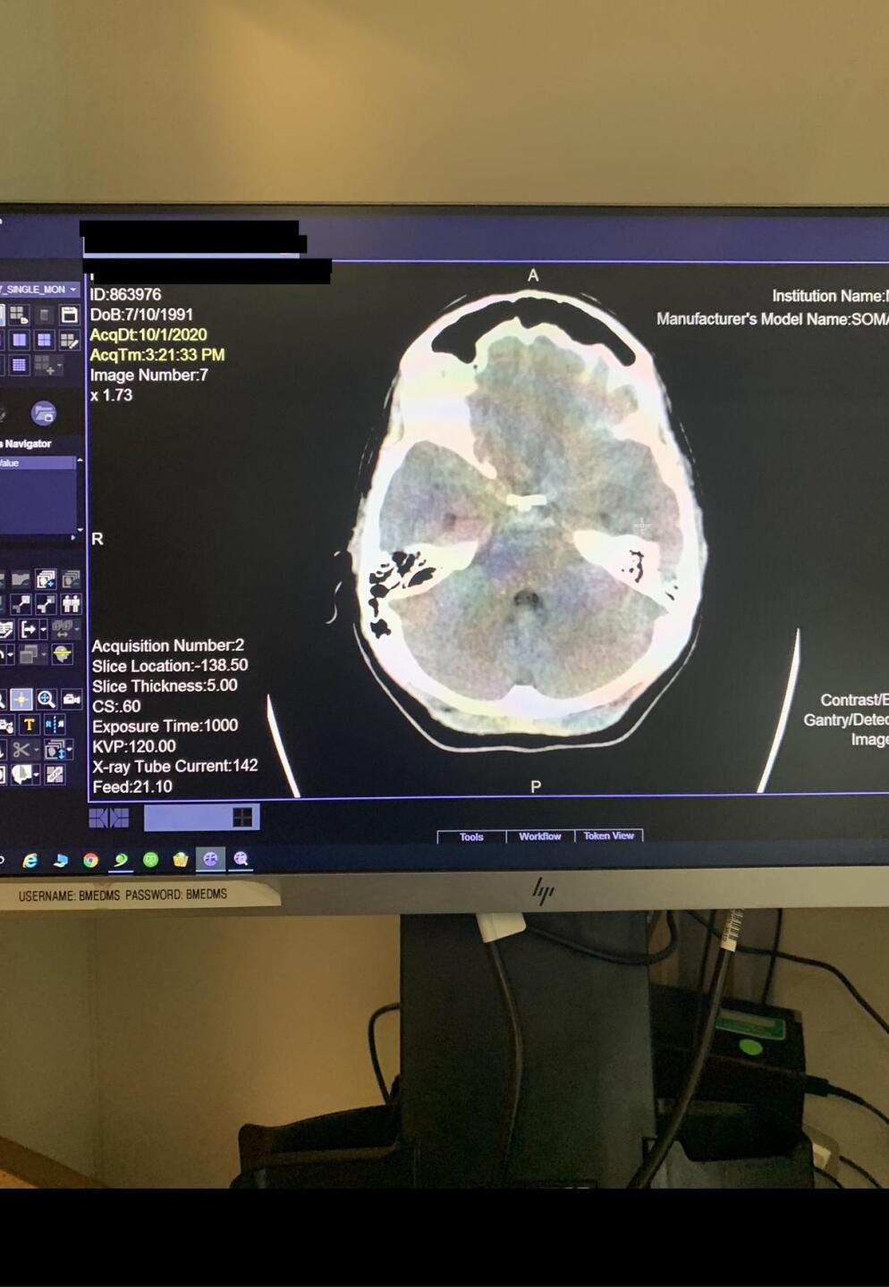 Doctors say Reich was bleeding around her brain all day.