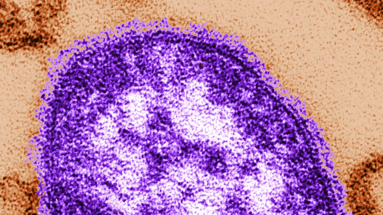 Measles case