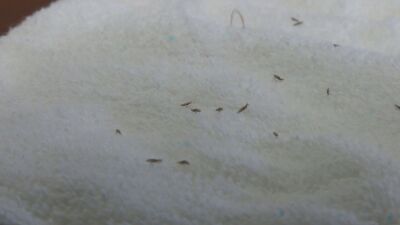 head lice