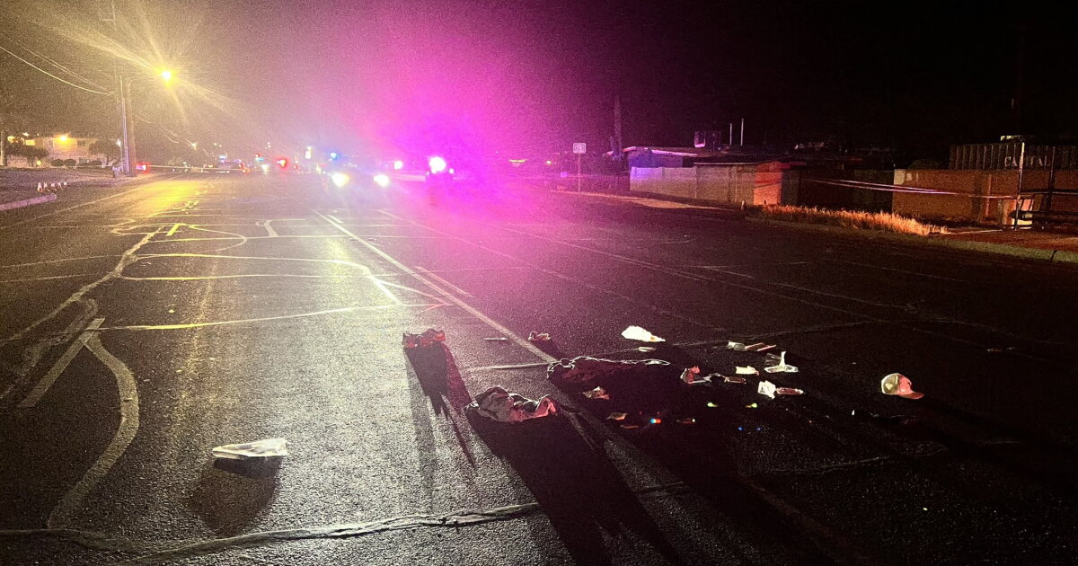 Man faces serious injuries after hit and run crash