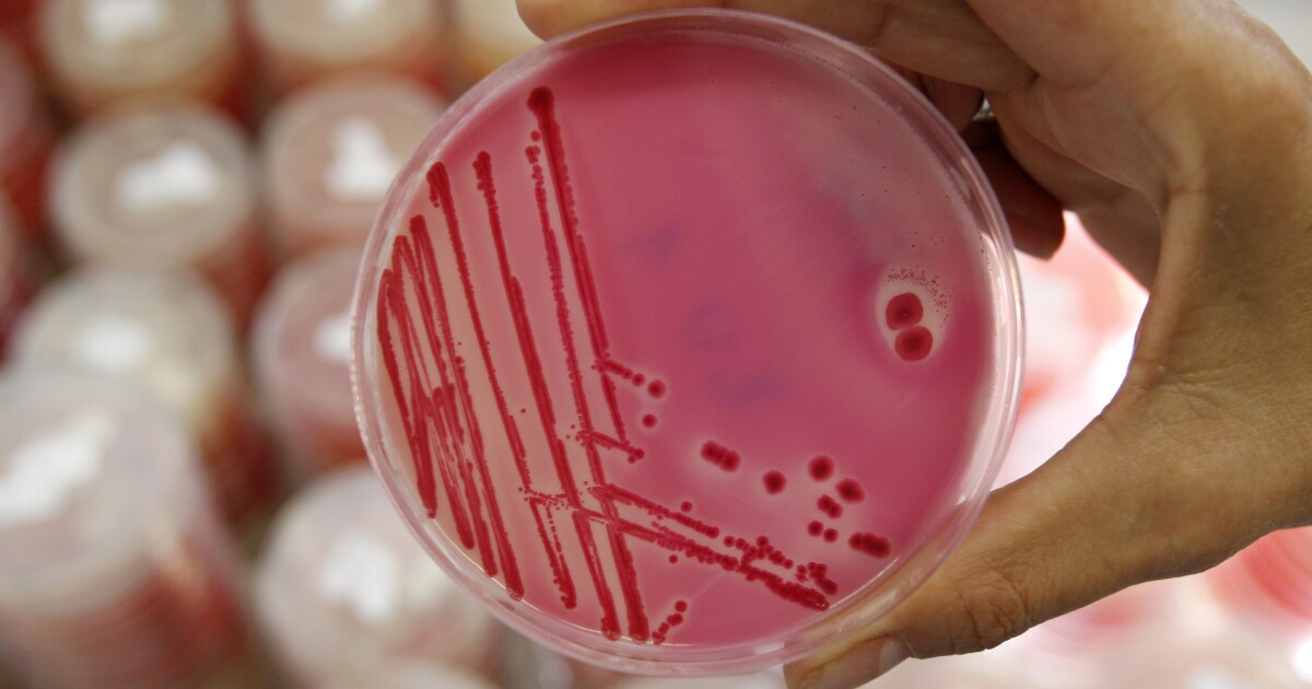 Colorado is seeing a ‘significant increase’ in salmonella cases. Here’s what you should know. - Denver7