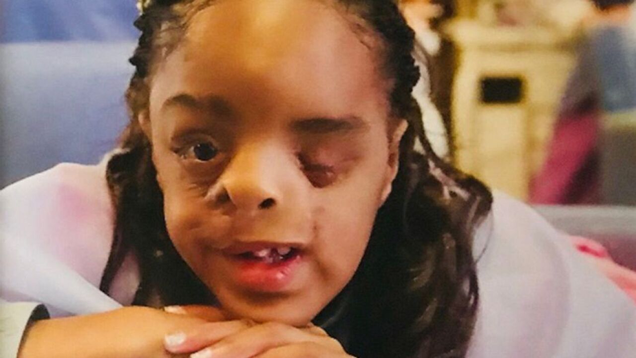 11 Year Old Girl Teaches Valuable Lesson About Embracing What