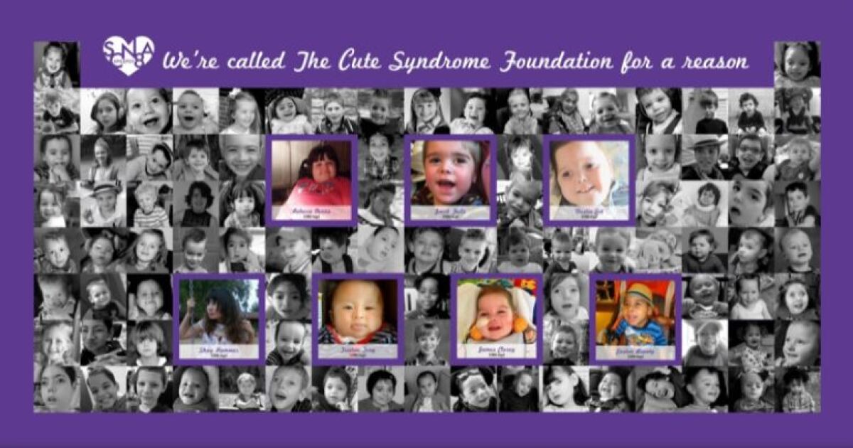 UVA researchers discover seizure trigger in rare form of epilepsy