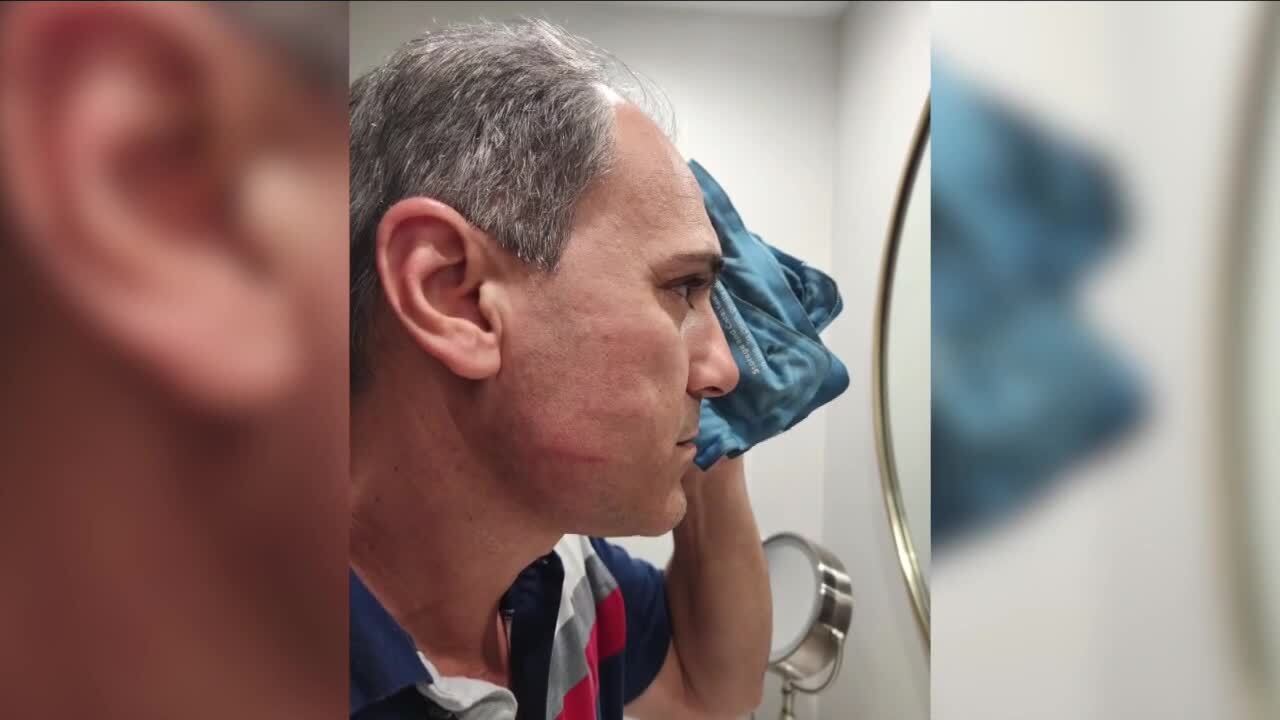 Helena's husband attacked after West Palm Beach car gathering