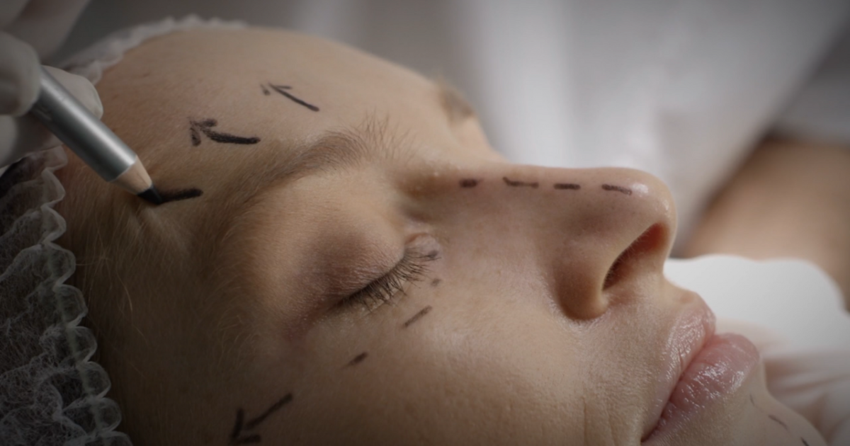 Utah teens among thousands of adolescents seeking plastic surgery each year