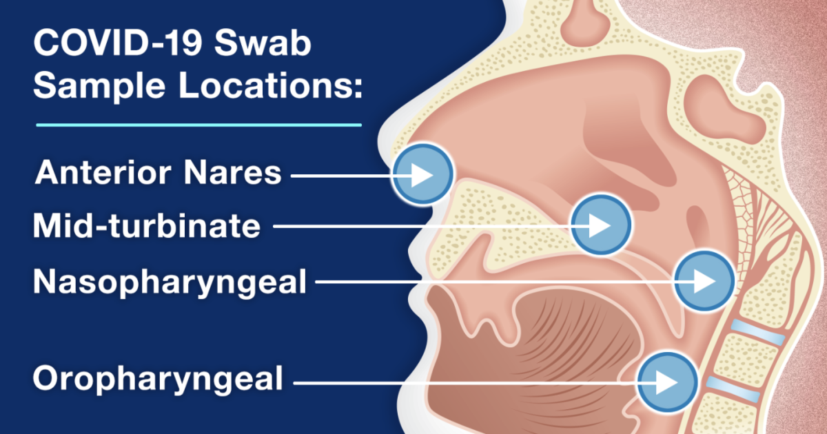 Should you swab your throat at home for COVID19?