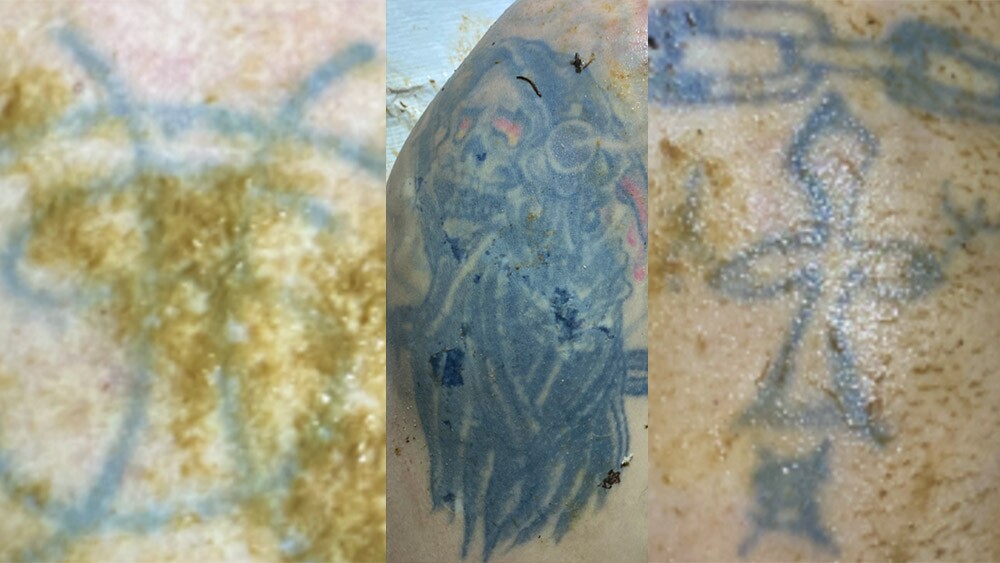 Investigators hope tattoos can help ID body found in Seneca Creek.jpg