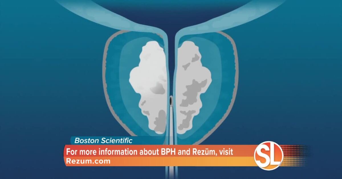 15 Second Water Hack For Prostate Health Treatment options for BPH