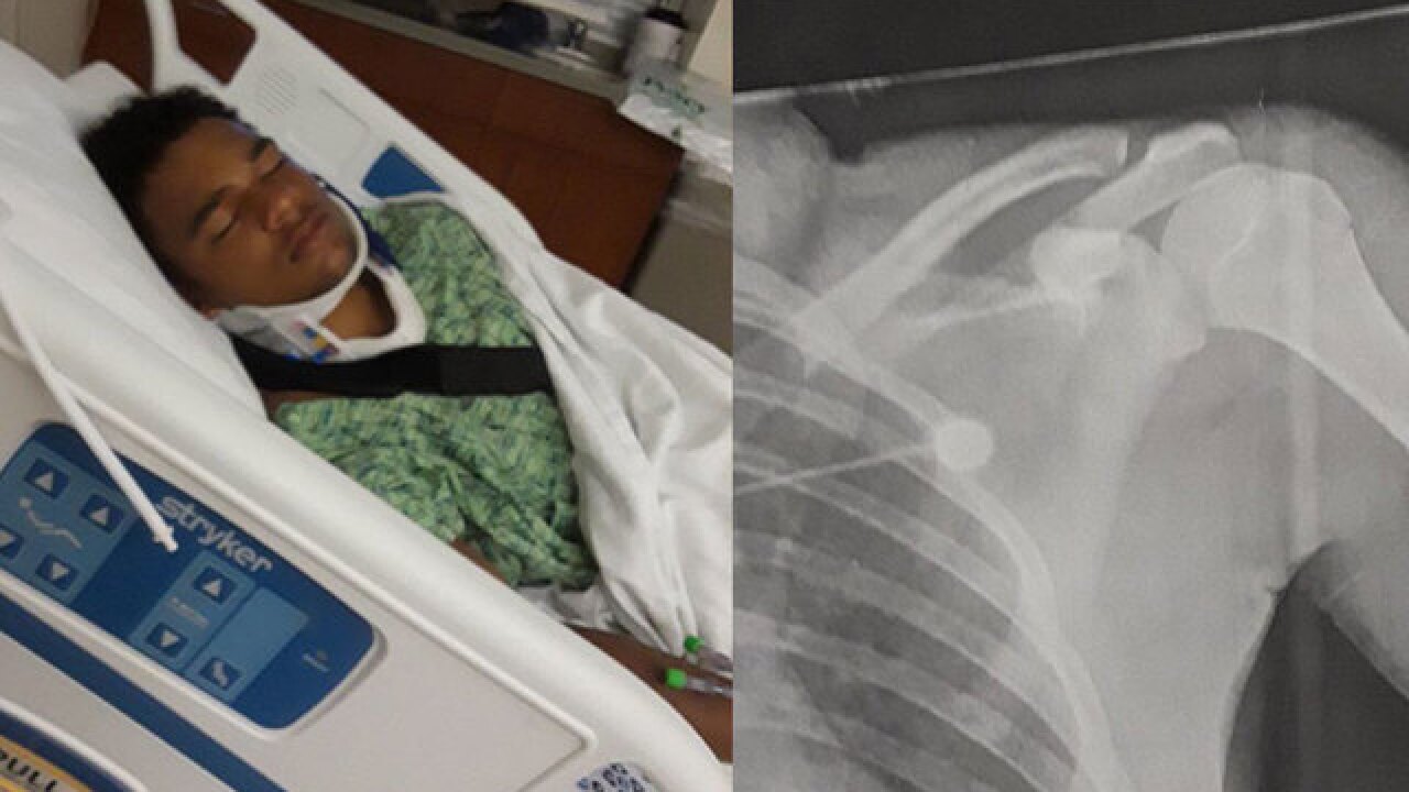Teen athlete released from hospital after fight